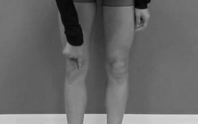 MCL Continuum Distortion