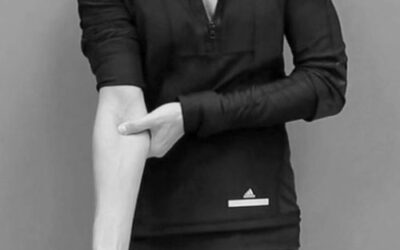 Cubital Fossa Continuum Distortion