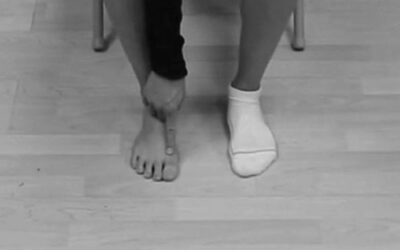 Hallux Continuum Distortion