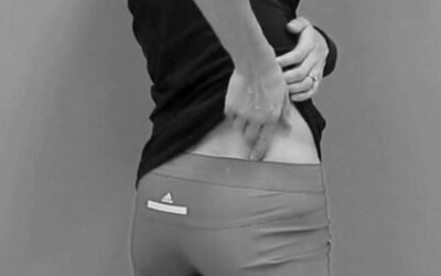 Iliac Crest Continuum Distortion