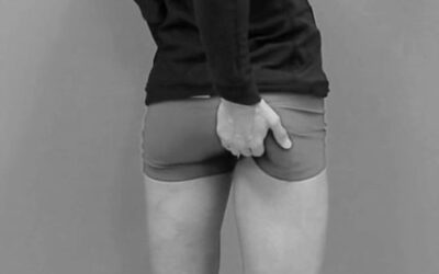 Ischial Tuberosity Continuum Distortion