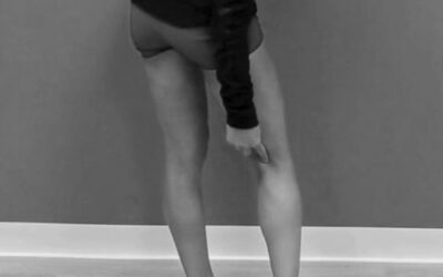 Popliteal Continuum Distortion