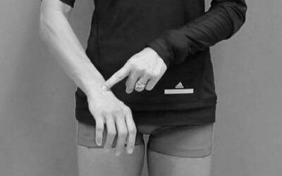 Posterior Wrist Continuum Distortion