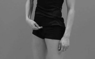 Pubic Symphysis Continuum Distortion