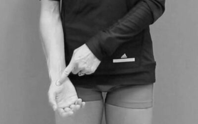 Thenar Continuum Distortion