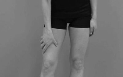 Thigh Folding Distortion