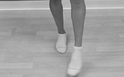 Ankle Tectonic Fixation